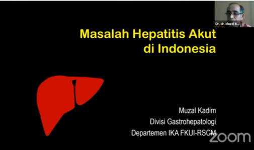FKM UI Gelar Seminar Online Bertema Hepatitis Akut Misterius Pada Anak, Bagaimana Sistem Pelayanan Kesehatan Bersiap?